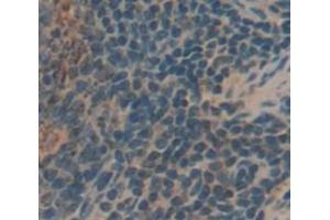 Immunohistochemistry (IHC) image for anti-Killer Cell Immunoglobulin-Like Receptor, Two Domains, Short Cytoplasmic Tail, 4 (KIR2DS4) (AA 22-302) antibody (ABIN1859540)
