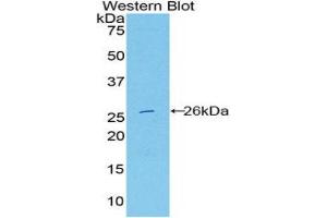 Western Blotting (WB) image for anti-Deoxyribonuclease I-Like 2 (DNASE1L2) (AA 32-229) antibody (ABIN3209086) (DNASE1L2 抗体  (AA 32-229))