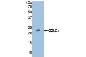Detection of Recombinant HDAC6, Human using Polyclonal Antibody to Histone Deacetylase 6 (HDAC6) (HDAC6 抗体  (AA 166-348))