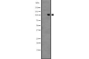 Western blot analysis of PKN3 expression in Hela cell lysate,The lane on the left is treated with the antigen-specific peptide. (PKN3 抗体  (Internal Region))