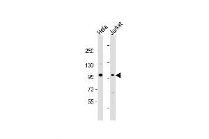 Western Blot at 1:1000 dilution Lane 1: Hela whole cell lysate Lane 2: Jurkat whole cell lysate Lysates/proteins at 20 ug per lane. (NSUN2 抗体  (AA 423-451))