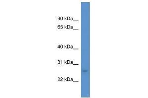 Western Blot showing CALB1 antibody used at a concentration of 1. (CALB1 抗体  (C-Term))