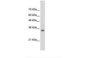 Image no. 1 for anti-Homeobox B4 (HOXB4) (C-Term) antibody (ABIN6736307) (HOXB4 抗体  (C-Term))