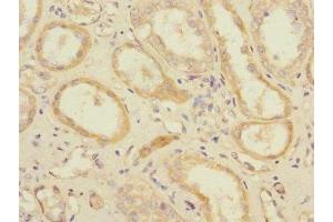 Immunohistochemistry of paraffin-embedded human kidney tissue using ABIN7152247 at dilution of 1:100 (SLC1A7 抗体  (AA 115-220))