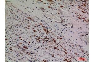 Immunohistochemistry (IHC) analysis of paraffin-embedded Human Brain, antibody was diluted at 1:100. (HDC 抗体  (Internal Region))