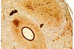 ABIN6261746 and ABIN6268882 at 1/100 staining Mouse ovary tissue by IHC-P.