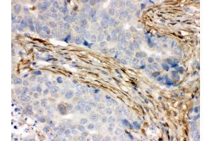 Anti- S100 alpha 6 Picoband antibody, IHC(P) IHC(P): Human Mammary Cancer Tissue