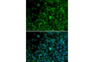 Immunofluorescence analysis of U20S cell using IRF4 antibody.