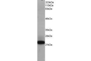 Western Blotting (WB) image for anti-MYC Associated Factor X (MAX) antibody (ABIN5871017) (MAX 抗体)