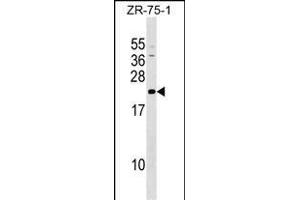 GRPEL1 Antibody (Center) (ABIN1537772 and ABIN2849483) western blot analysis in ZR-75-1 cell line lysates (35 μg/lane). (GRPEL1 抗体  (AA 116-142))