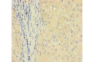 Immunohistochemistry of paraffin-embedded human liver tissue using ABIN7172006 at dilution of 1:100 (TXNDC8 抗体  (AA 1-115))