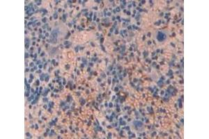 Used in DAB staining on fromalin fixed paraffin- embedded spleen tissue (TPM3 抗体  (AA 6-248))