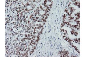 Image no. 2 for anti-Tumor Protein P53 (TP53) antibody (ABIN1499973) (p53 抗体)