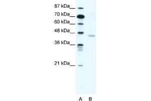 WB Suggested Anti-CNP Antibody Titration:  1. (Cnpase 抗体  (N-Term))