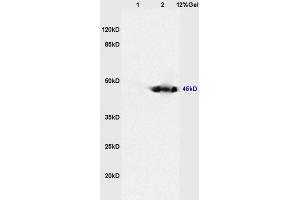 SDS-PAGE (SDS) image for anti-Pleckstrin Homology Domain Containing, Family O Member 1 (PLEKHO1) (AA 51-170) antibody (ABIN675039)