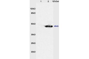Lane 1: mouse heart lysates Lane 2: mouse kidney lysates probed with Anti CKIP-1 Polyclonal Antibody, Unconjugated (ABIN675039) at 1:200 in 4 °C. (PLEKHO1 抗体  (AA 51-170))