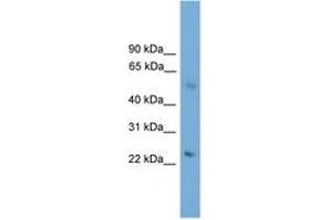 Image no. 1 for anti-Bardet-Biedl Syndrome 4 (BBS4) (AA 71-120) antibody (ABIN6745205) (BBS4 抗体  (AA 71-120))