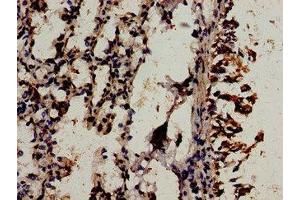 Immunocytochemistry analysis of human lung tissue using ABIN7175842 at dilution of 1:100 (WIF1 抗体  (AA 263-379))
