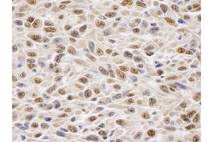 Immunohistochemistry (IHC) image for anti-Glyceraldehyde-3-Phosphate Dehydrogenase (GAPDH) (AA 250-300) antibody (ABIN7448576)