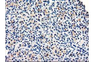 Image no. 1 for anti-Dipeptidylpeptidase 10 (DPP10) antibody (ABIN1497834) (DPP10 抗体)