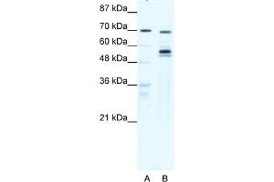 WB Suggested Anti-DDX55 Antibody Titration:  0. (DDX55 抗体  (N-Term))