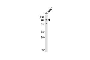 Western blot analysis of lysate from mouse heart tissue lysate, using HAS2 Antibody (Center) (ABIN651874 and ABIN2840432).