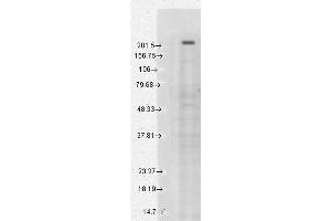 Western Blot analysis of Human Cell lysates showing detection of TrpM7 protein using Mouse Anti-TrpM7 Monoclonal Antibody, Clone S74-25 . (TRPM7 抗体  (AA 1817-1863) (PE))