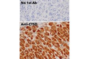 Immunohistochemistry (IHC) image for anti-Cathepsin D (CTSD) (C-Term) antibody (ABIN6254162)