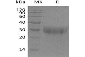 Western Blotting (WB) image for Placenta Growth Factor (PGF) (Active) protein (His tag) (ABIN7320626)