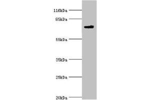 Western blot All lanes: MTMR7 antibody at 2 μg/mL + Mouse brain tissue Secondary Goat polyclonal to rabbit IgG at 1/10000 dilution Predicted band size: 76, 65 kDa Observed band size: 76 kDa (MTMR7 抗体  (AA 1-660))