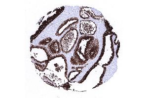 Prostate (Recombinant Prosaposin 抗体)