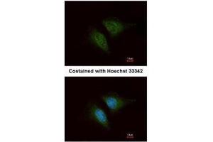 ICC/IF Image Immunofluorescence analysis of methanol-fixed HeLa, using Coronin 1C, antibody at 1:200 dilution. (CORO1C 抗体  (C-Term))