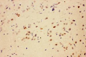 Anti-SIAH Interacting Protein antibody,IHC(P) IHC(P): Rat Brain Tissue (CACYBP 抗体  (Middle Region))