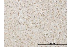 Image no. 1 for anti-LIM Homeobox 4 (LHX4) (AA 208-307) antibody (ABIN599314) (LHX4 抗体  (AA 208-307))