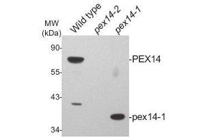 Western Blotting (WB) image for anti-Peroxisomal Biogenesis Factor 14 (PEX14) (N-Term), (pHis6) antibody (ABIN5326727) (PEX14 抗体  (N-Term, pHis6))