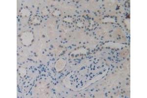 Detection of EBI3 in Human Kidney Tissue using Monoclonal Antibody to Epstein Barr Virus Induced Protein 3 (EBI3) (EBI3 抗体  (AA 21-229))