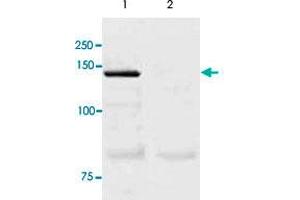 The tissue lysate derived from mouse lung was immunoprecipitated by NOS3 polyclonal antibody , then immuno-blotted by the same antibody at 1 : 500 (lane 1). (ENOS 抗体  (C-Term))
