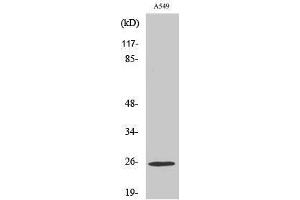 Western Blotting (WB) image for anti-rho GDP Dissociation Inhibitor (GDI) gamma (ARHGDIG) (Internal Region) antibody (ABIN3180861) (ARHGDIG 抗体  (Internal Region))