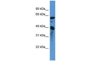 WB Suggested Anti-CNN3 Antibody Titration: 0. (CNN3 抗体  (C-Term))
