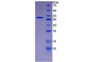 SDS-PAGE analysis of Human Keratin 18 Protein. (Cytokeratin 18 蛋白)