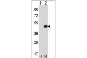 Western blot analysis of EIF2B3 (arrow) using rabbit polyclonal EIF2B3 Antibody (ABIN388637 and ABIN2838310).