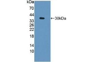 Detection of Recombinant GBP4, Mouse using Polyclonal Antibody to Guanylate Binding Protein 4 (GBP4) (GBP4 抗体  (AA 1-304))