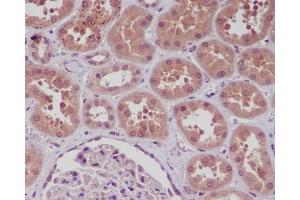 Immunohistochemical analysis of paraffin-embedded human kidney, using NF-κB p105/p50 Antibody. (Recombinant NFkB 抗体)