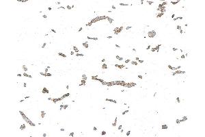Immunocytochemistry (ICC) image for anti-Desmoglein 3 (DSG3) antibody (ABIN7795599) (Desmoglein 3 抗体)