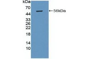 Western Blotting (WB) image for anti-Protein Kinase, AMP-Activated, beta 1 Non-Catalytic Subunit (PRKAB1) (AA 13-242) antibody (ABIN7433912)