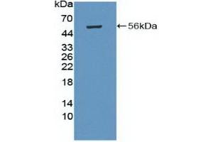 Detection of Recombinant PRKAb1, Human using Polyclonal Antibody to Protein Kinase, AMP Activated Beta 1 (PRKAb1) (PRKAB1 抗体  (AA 13-242))