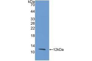 Detection of Recombinant IL8, Rabbit using Monoclonal Antibody to Interleukin 8 (IL8)