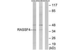 Western blot analysis of extracts from COLO/HuvEc cells, using RASSF4 Antibody. (RASSF4 抗体  (AA 134-183))