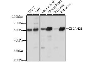 Western blot analysis of extracts of various cell lines, using ZSCAN21 antibody. (ZSCAN21 抗体)