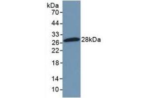 Detection of Recombinant NFkB2, Mouse using Polyclonal Antibody to Nuclear Factor Kappa B2 (NFkB2) (Nuclear Factor kappa B2 (AA 25-224) 抗体)